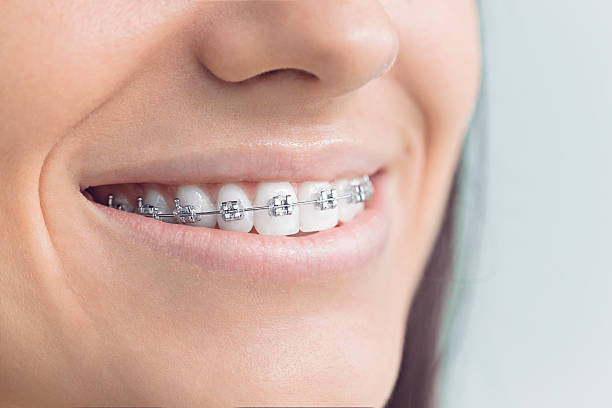 Best Invisalign and Clear Aligners  in New Castle Northwest, PA